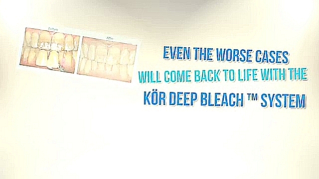Does KOR Deep Bleaching really work 