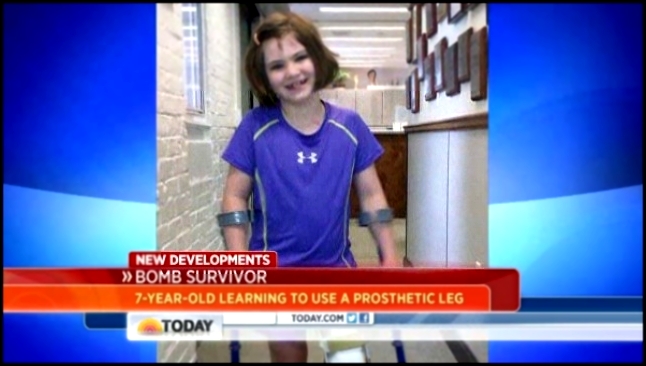 7-year-old Boston bombing victim dancing with new leg 