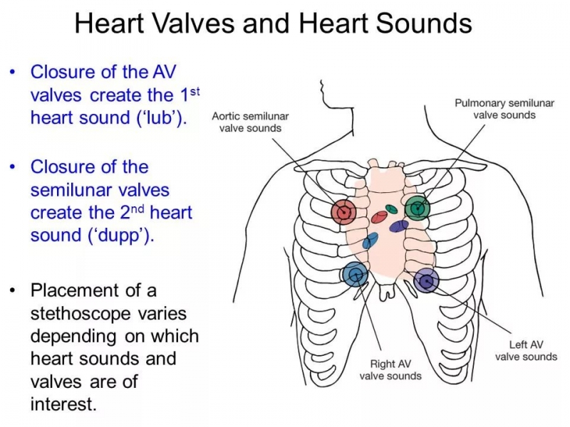 SoundOfHeart