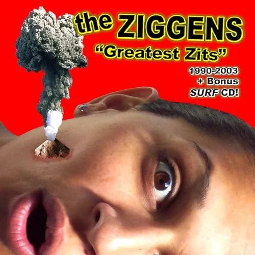 The Ziggens